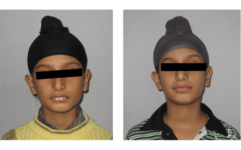 Class II Div 1 image 1