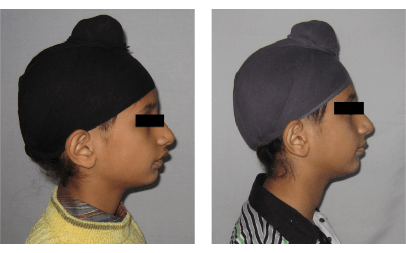 Class II Div 1 image 3