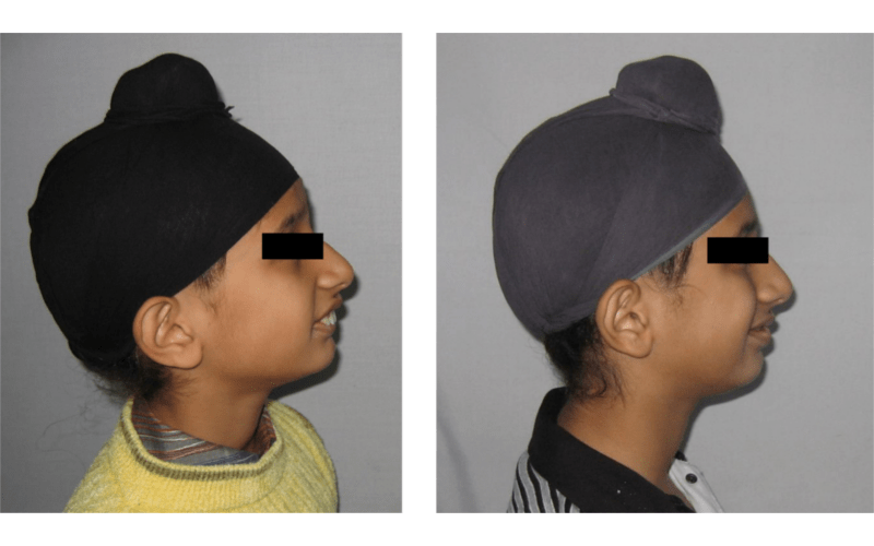 Class II Div 1 image 4