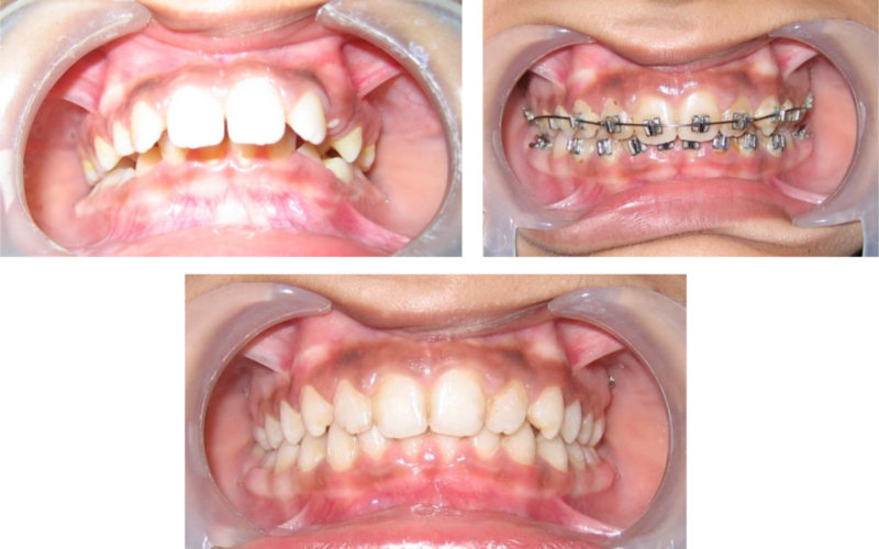 Class II Div 1 image 5