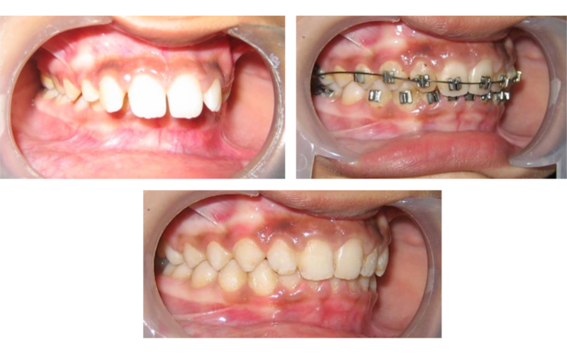 Class II Div 1 image 6