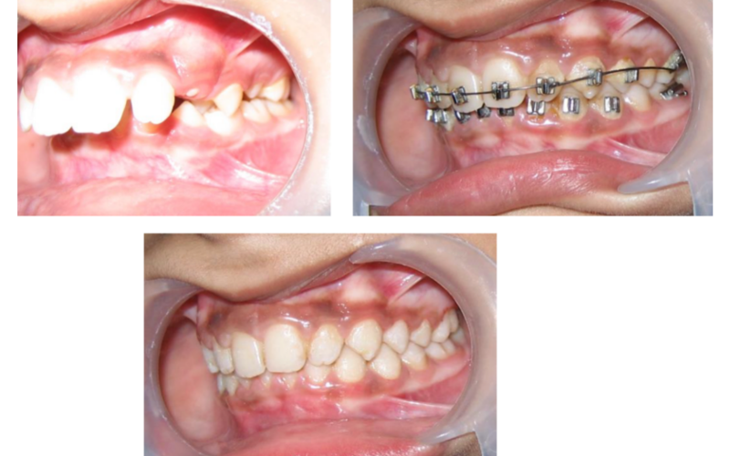 Class II Div 1 image 7