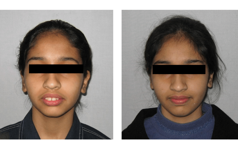 Class II Div 1 image 1