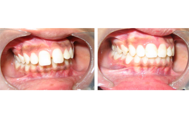 Class II Div 1 image 4