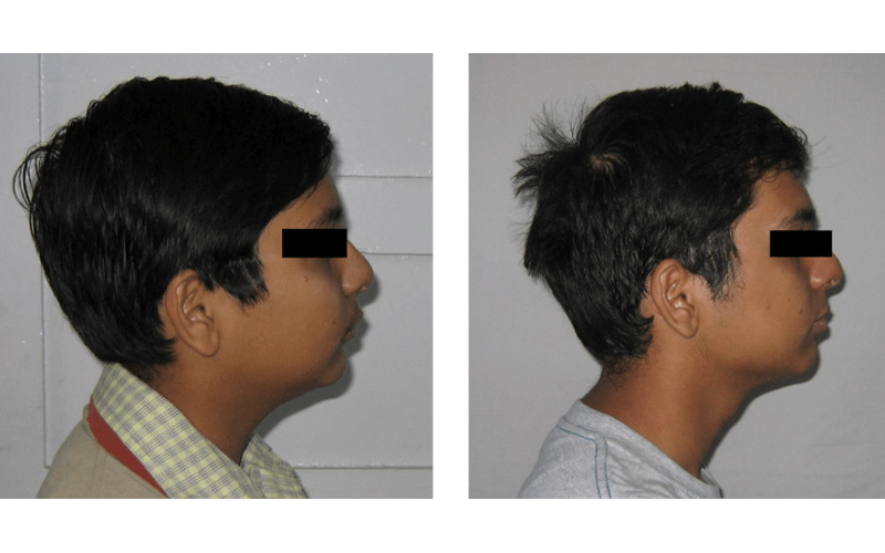 Class II Div 2 image 3