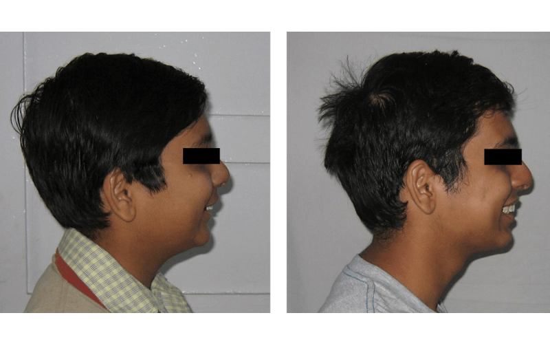 Class II Div 2 image 4