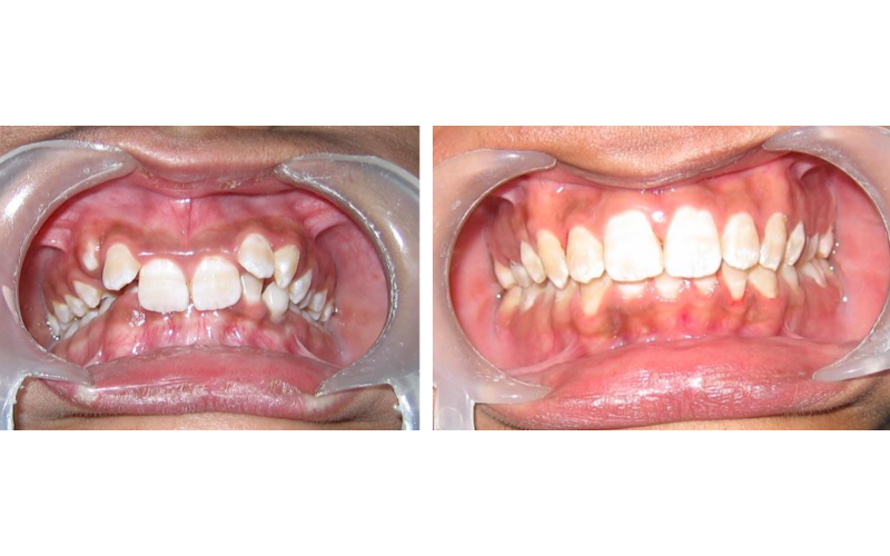 Class II Div 2 image 5