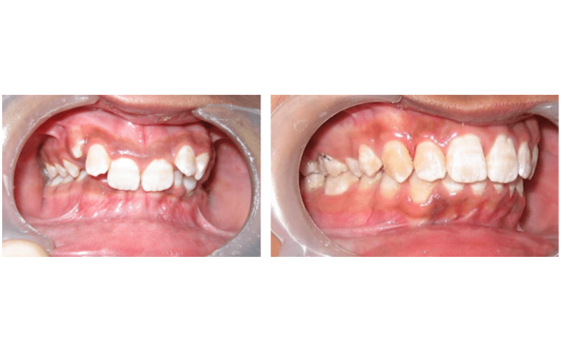 Class II Div 2 image 6