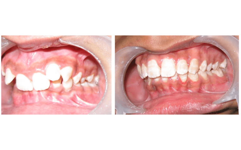 Class II Div 2 image 7