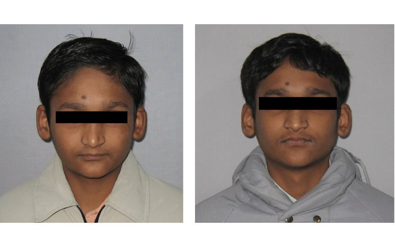 Class II Div 2 image 1