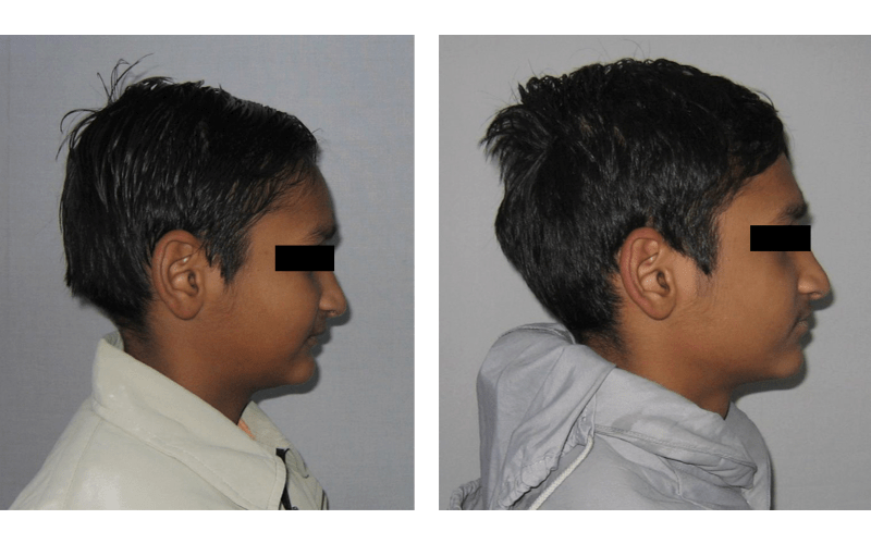 Class II Div 2 image 3