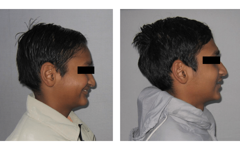 Class II Div 2 image 4