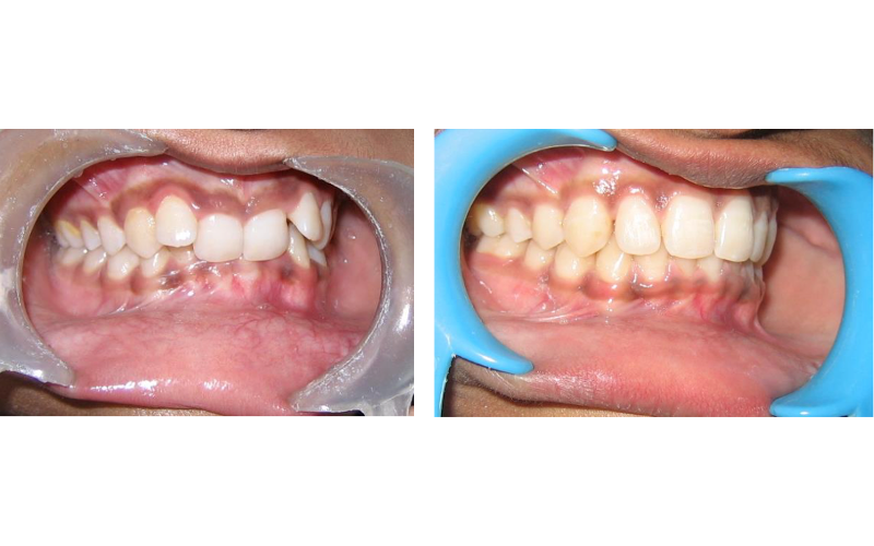 Class II Div 2 image 6