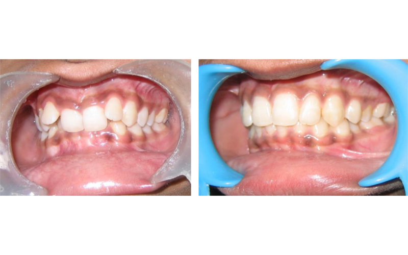 Class II Div 2 image 7