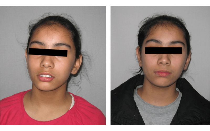 Class II Div 1 image 1