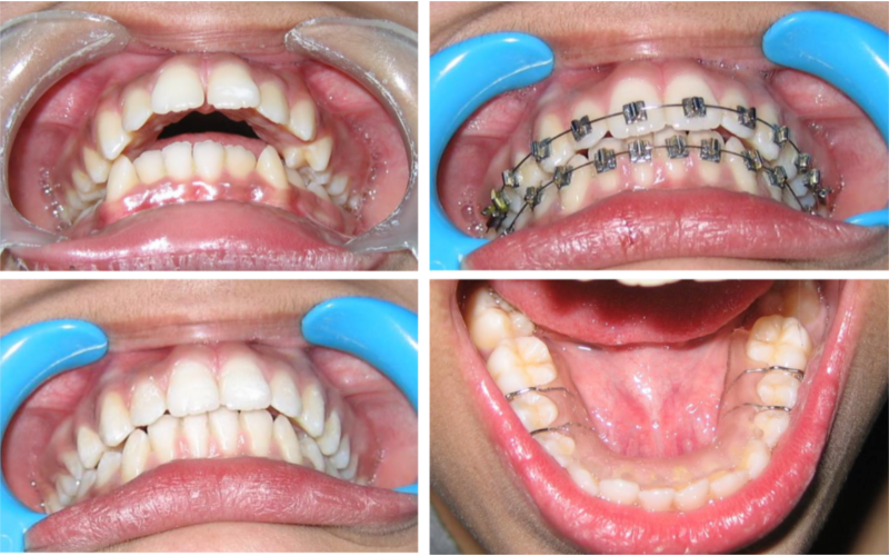 Class II Div 1 image 3