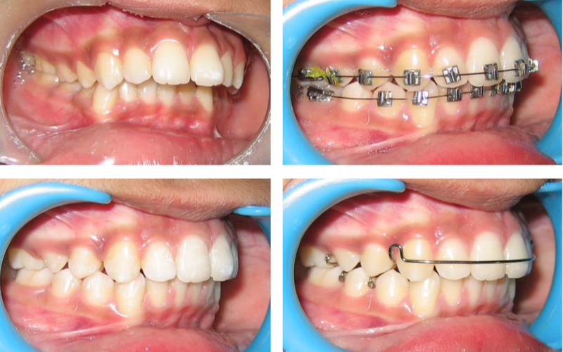 Class II Div 1 image 5