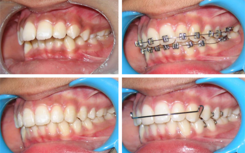 Class II Div 1 image 6