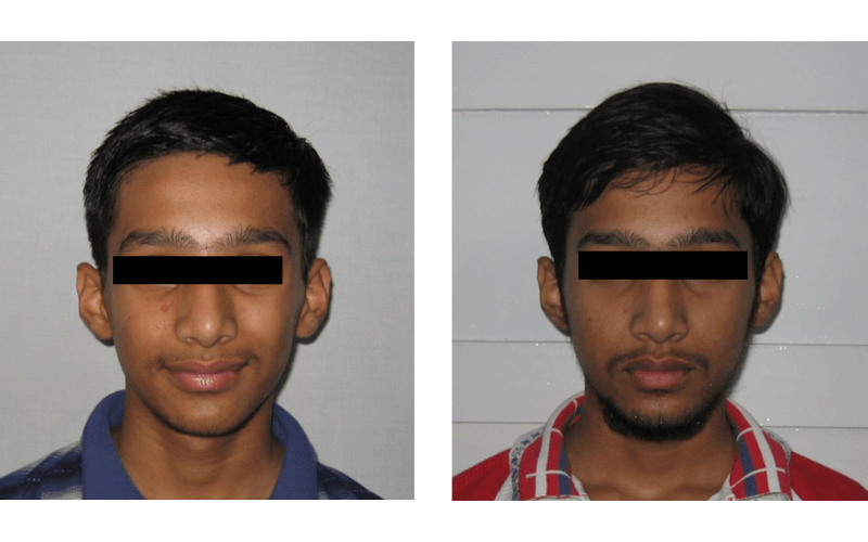 Class II Div 2 image 1