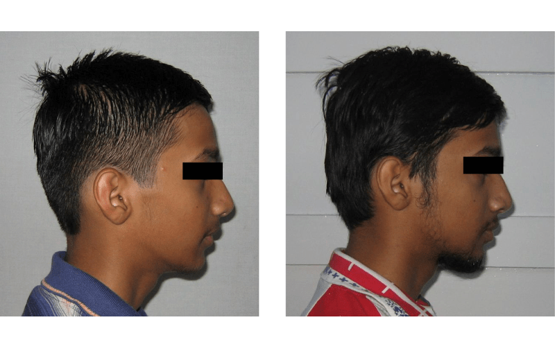 Class II Div 2 image 3