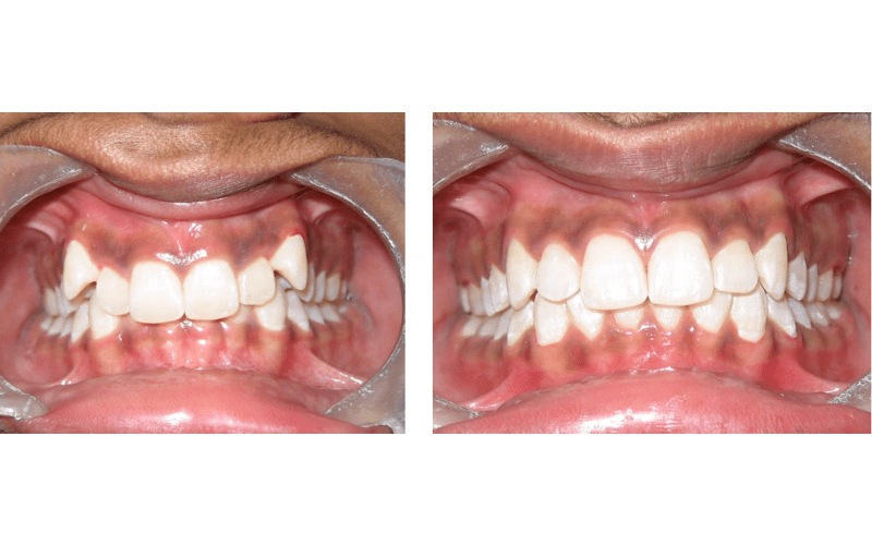 Class II Div 2 image 4