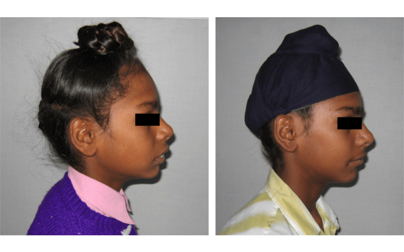 Class II Div 1 image 3