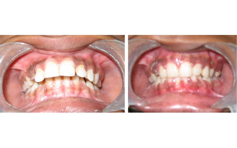 Class II Div 1 image 5