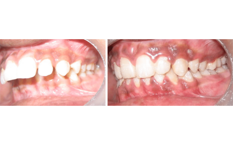 Class II Div 1 image 6