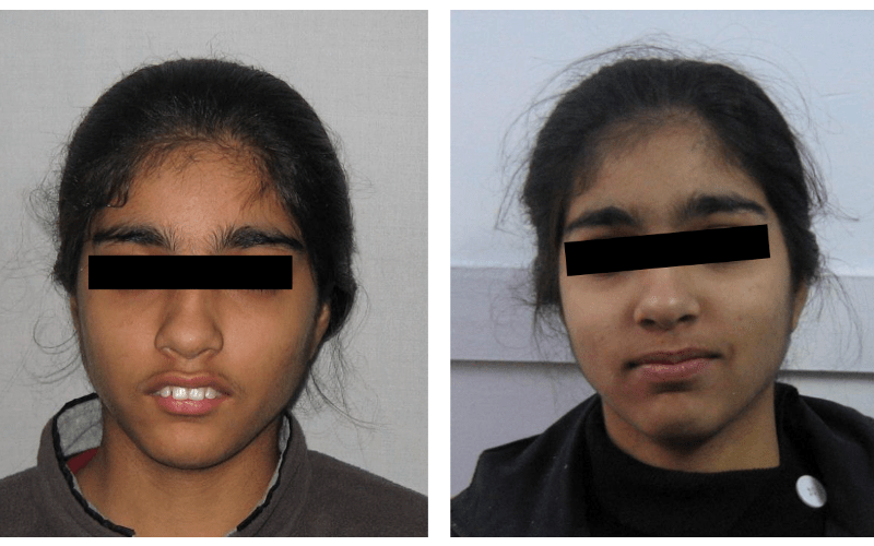 Class II Div 1 image 1