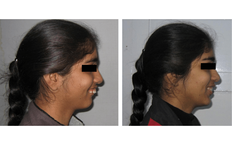 Class II Div 1 image 4