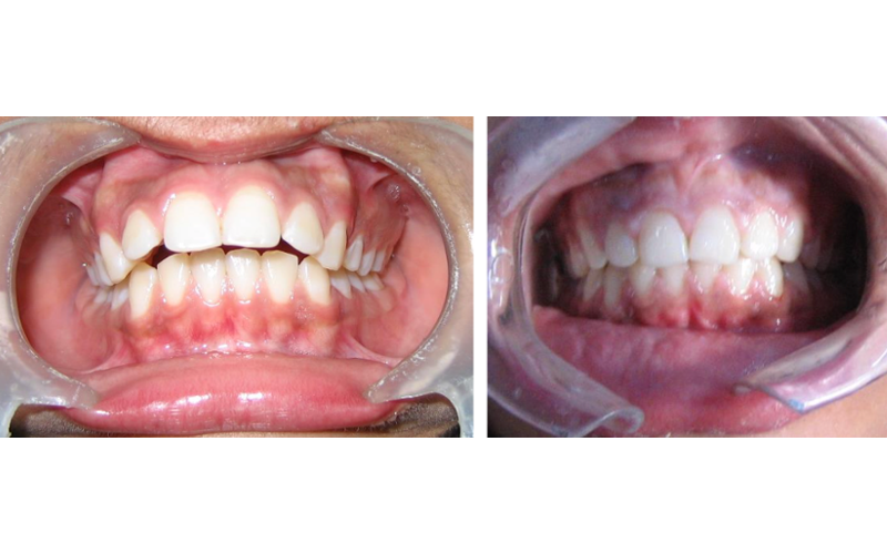 Class II Div 1 image 5