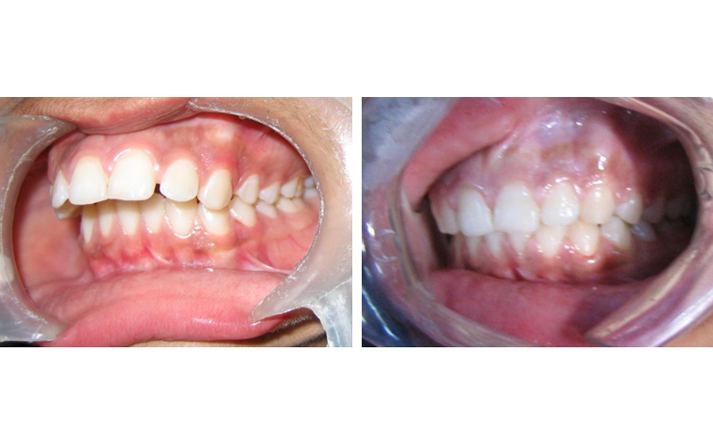 Class II Div 1 image 6