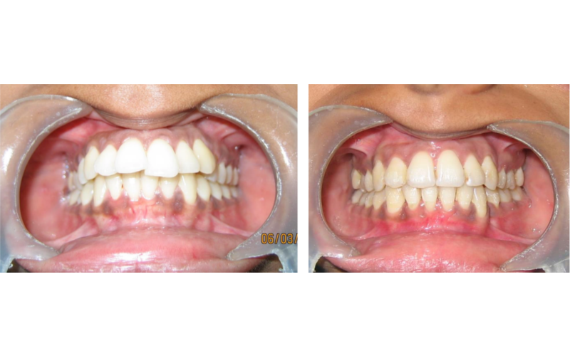 Class II Div 1 Subdivision image 4