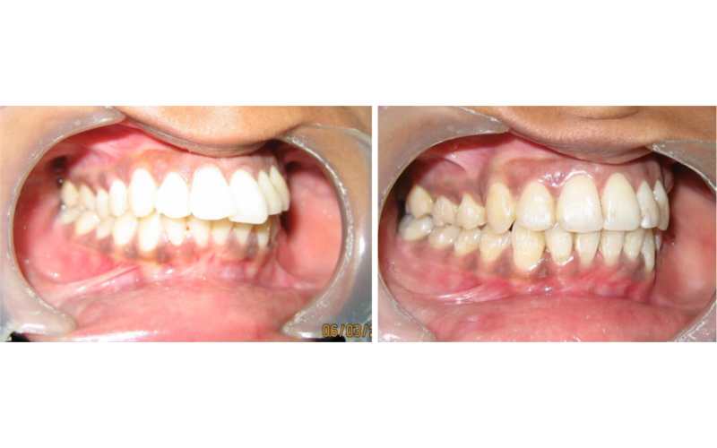 Class II Div 1 Subdivision image 5