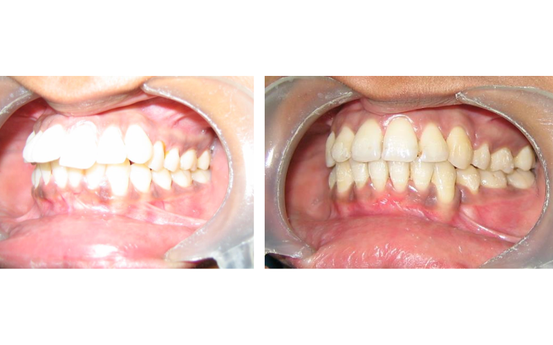 Class II Div 1 Subdivision image 6